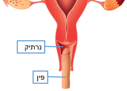 Female reproductive system 4.png