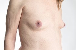 Breasts – Caisa.jpg